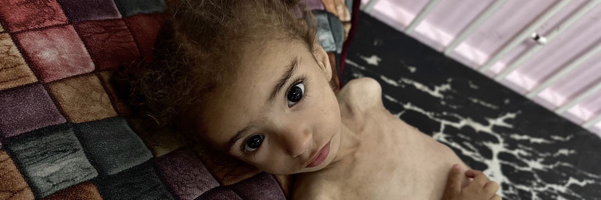 18-month-old Mayar El Arca is being treated at Nasser Hospital