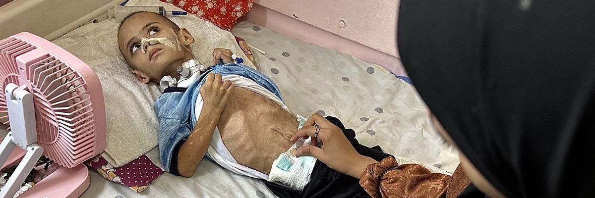 3-year-old Omar battles for life after losing family in Gaza strikes