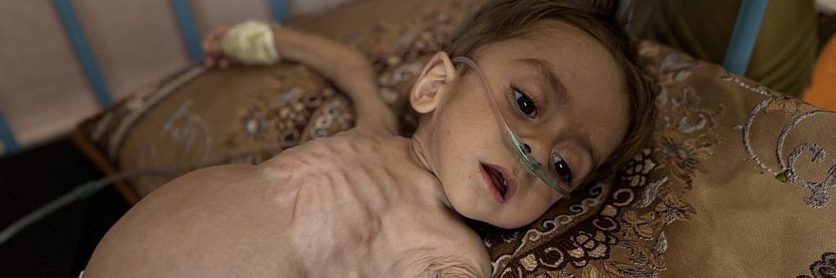 3-year-old Palestinian boy in critical condition due to health issues
