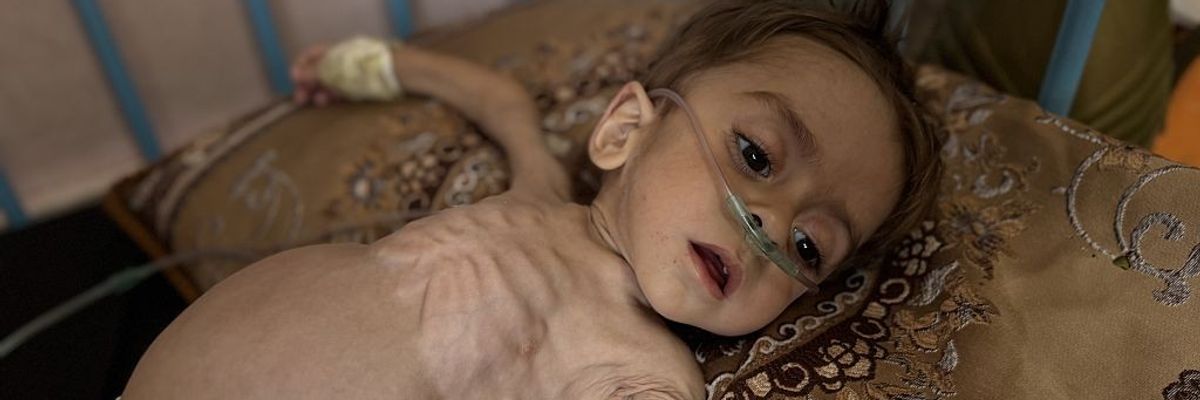 3-year-old Palestinian boy in critical condition due to health issues