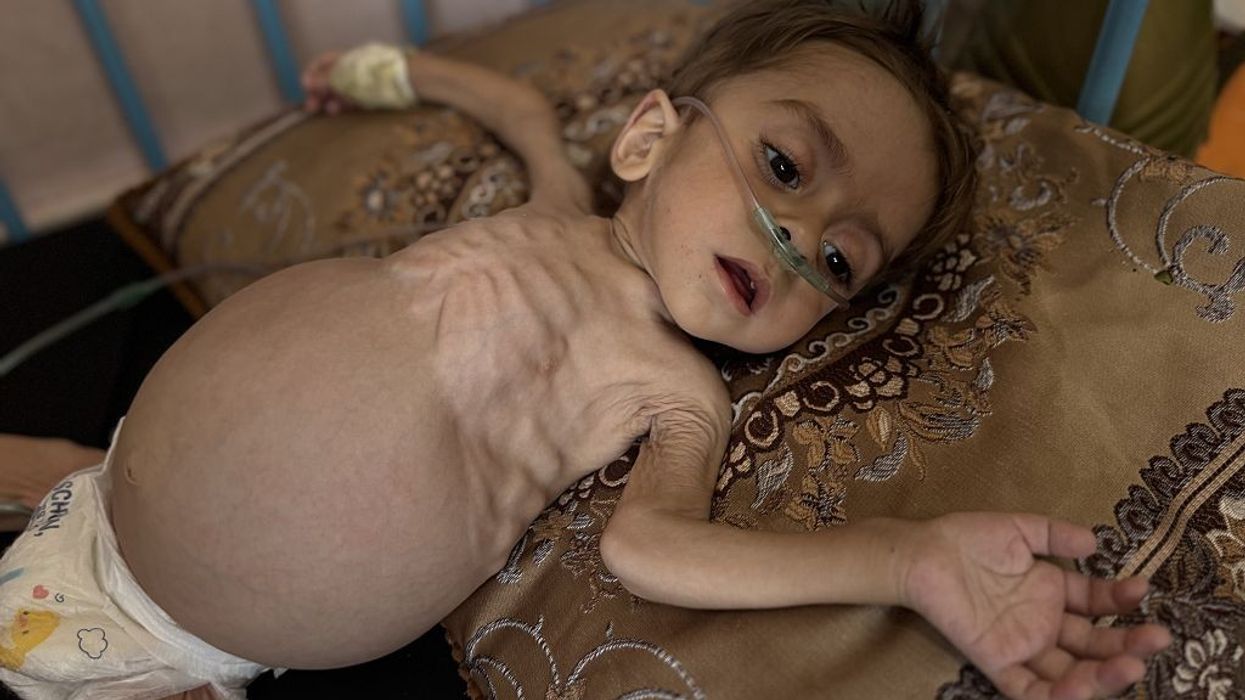 3-year-old Palestinian boy in critical condition due to health issues