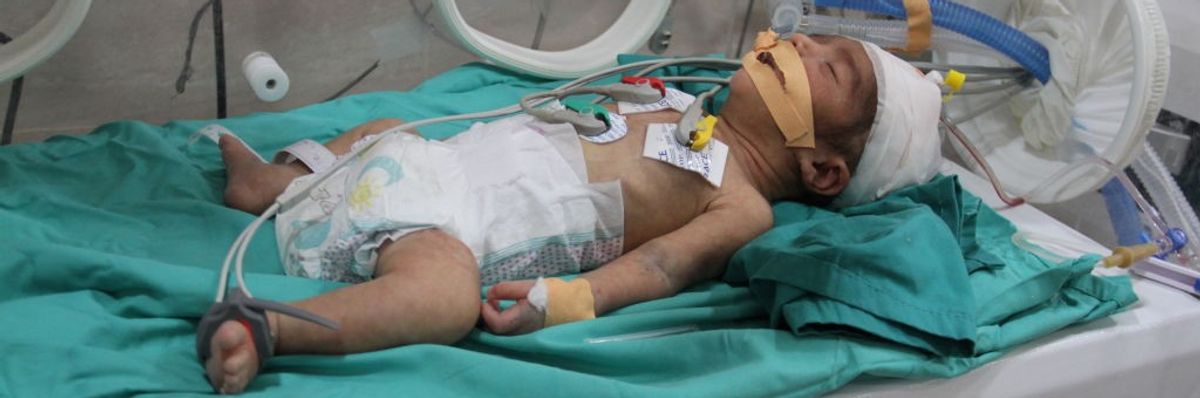 A baby, hospitalized due to malnutrition and dehydration, in Gaza on March 2, 2024