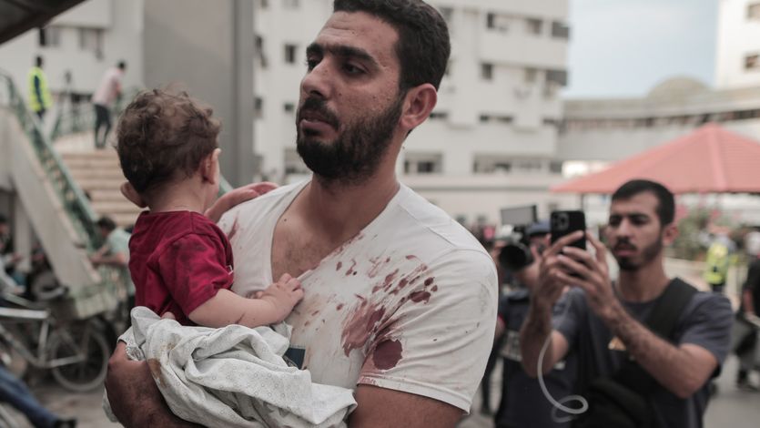 A bloodied Palestinian man and his baby arrive at Gaza hospital