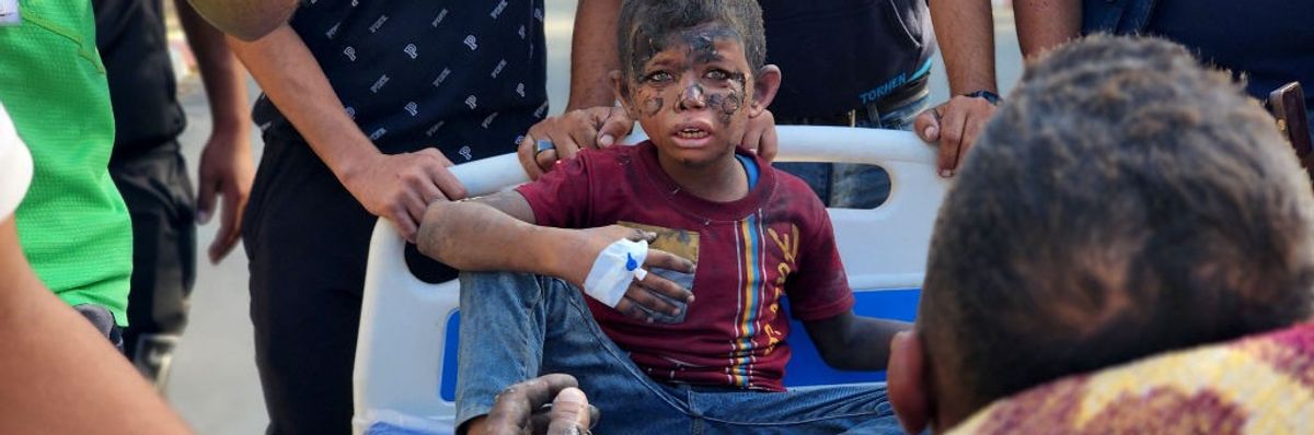 A burned Palestinian child is treated following an Israeli airstrike on Gaza
