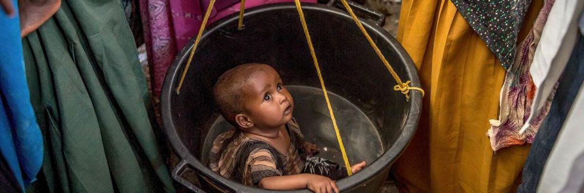 A child is screened for malnutrition at a health clinic in Baidoa, Somalia