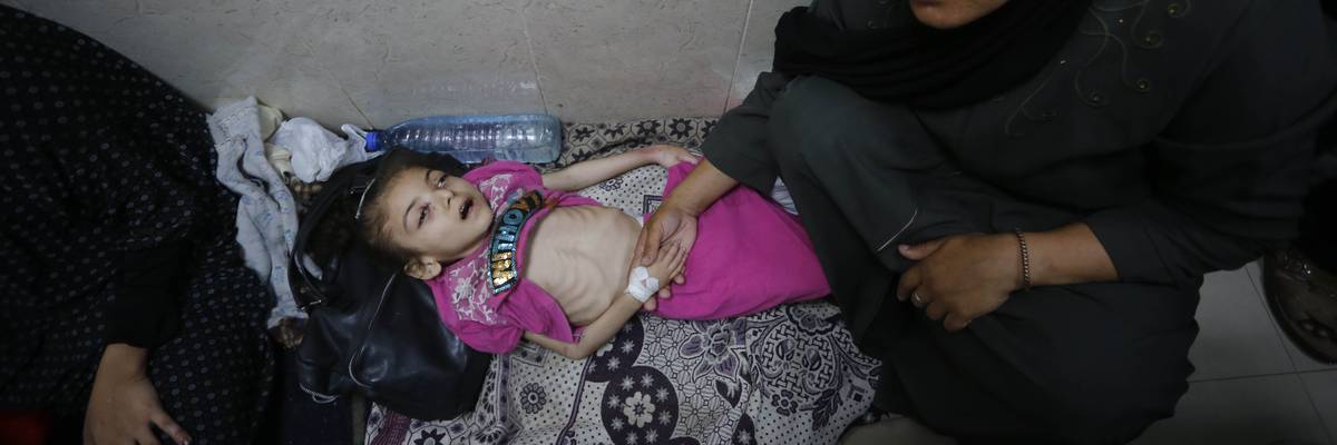 A child suffering from malnutrition is treated with severely limited supplies
