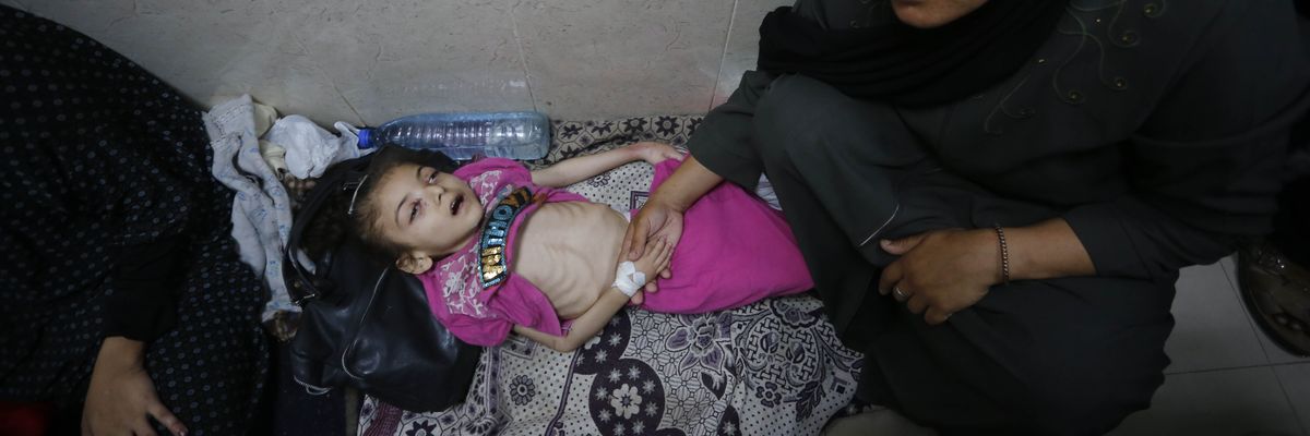A child suffering from malnutrition is treated with severely limited supplies
