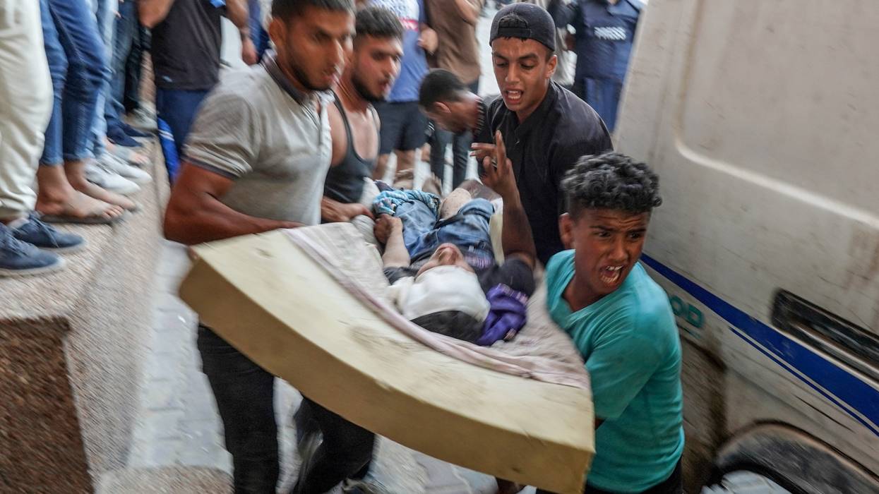 A child wounded by an Israeli attack