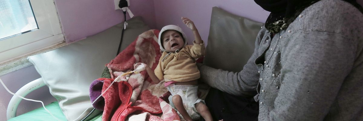 A mother tends to her child suffering from acute malnutrition