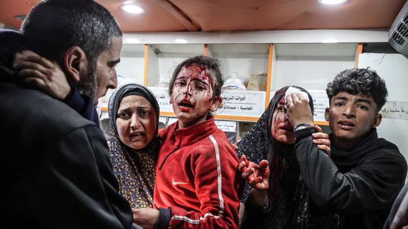 A Palestinian boy puts pressure on the head of a woman injured in an Israeli attack
