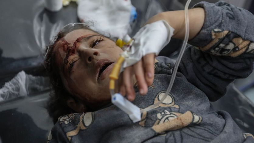 A Palestinian child injured in Israeli airstrikes