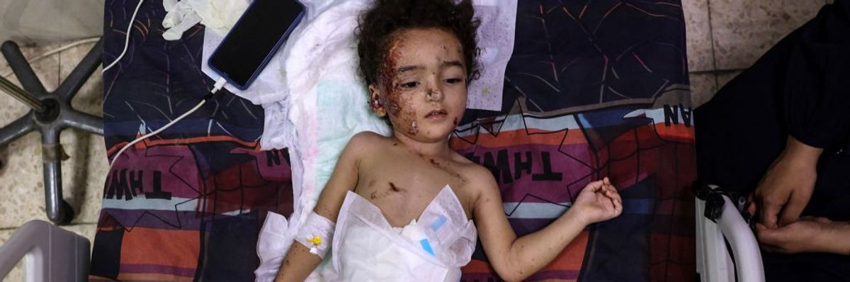 A Palestinian child severely wounded in Gaza
