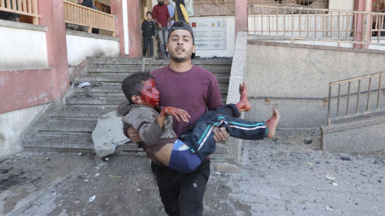 A Palestinian man carries a child, his face bloodied after being injured by an Israeli strike