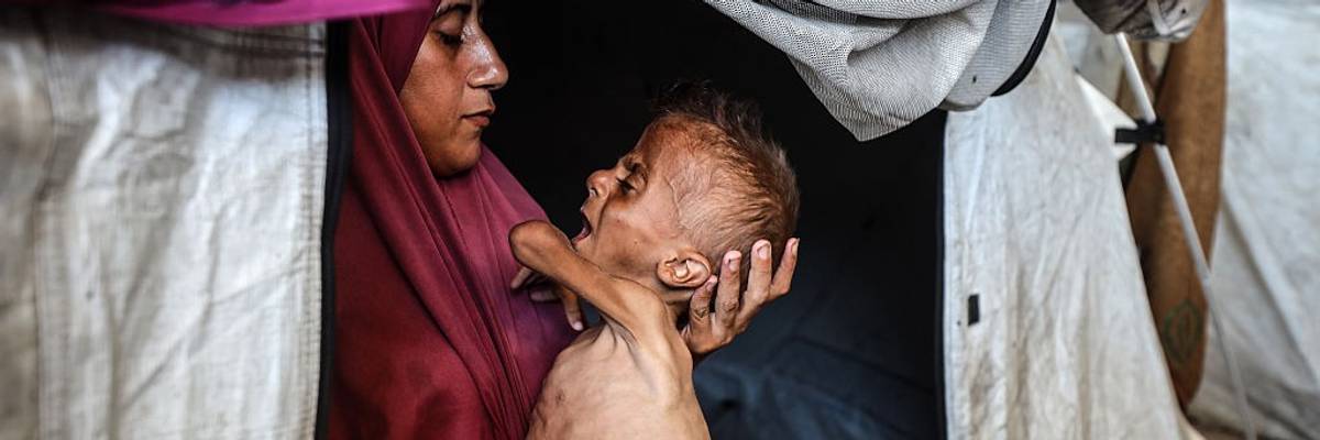 A Palestinian mother holds her starving infant