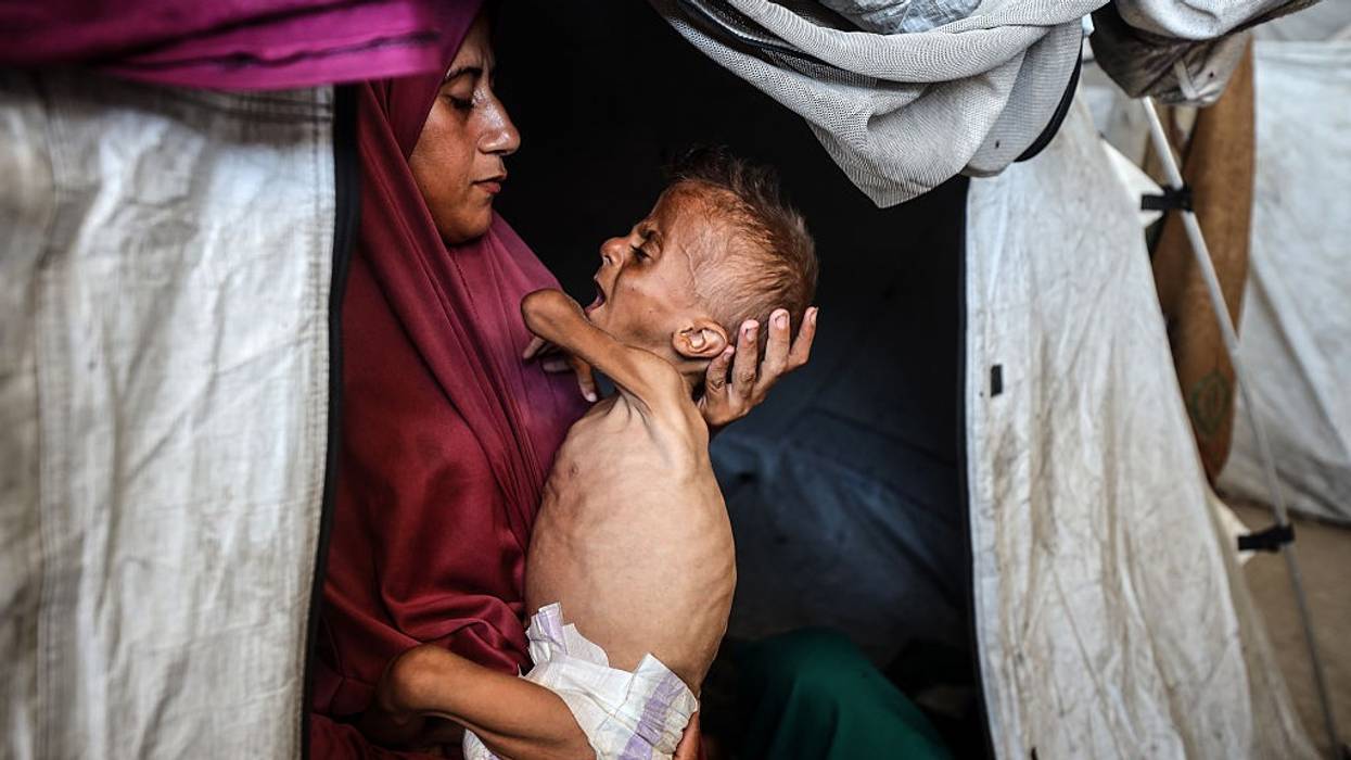 A Palestinian mother holds her starving infant