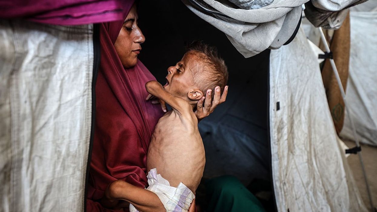 A Palestinian mother holds her starving infant