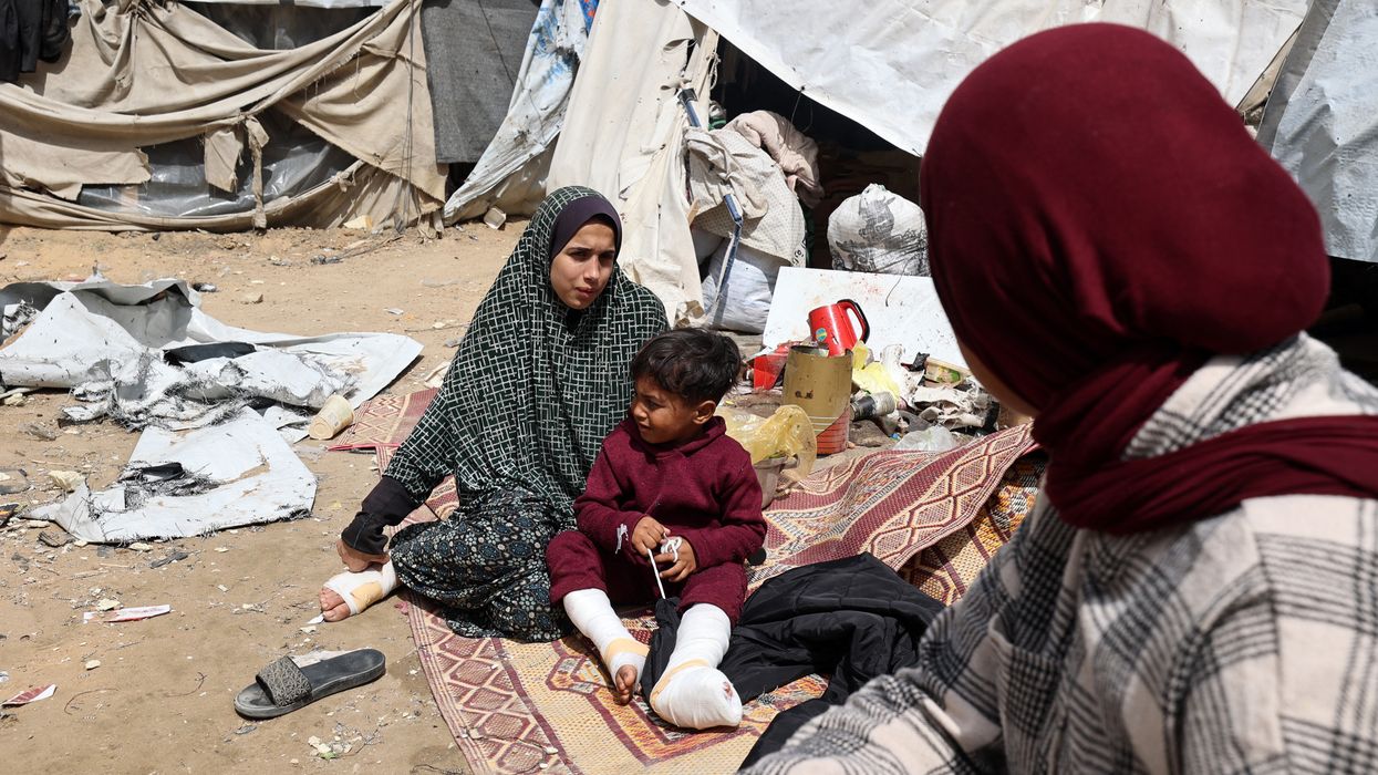 A Palestinian woman and child sit with injuries by a tent.