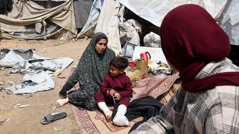 A Palestinian woman and child sit with injuries by a tent.