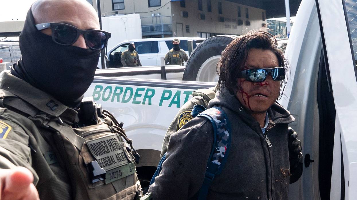 A person with a bloody face is arrested by a federal agent