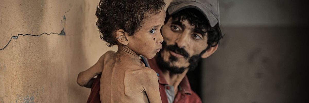 a starving child in Gaza