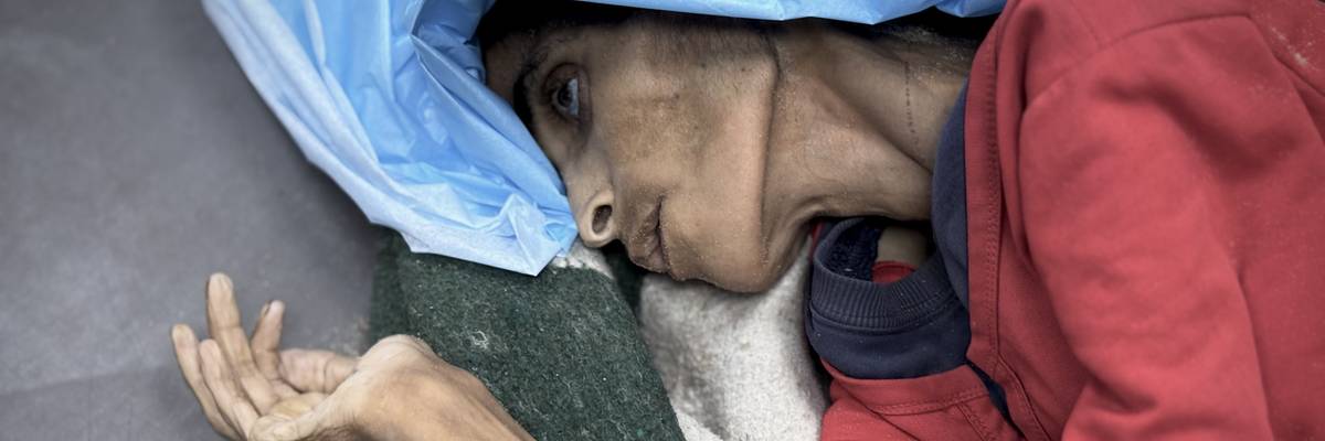 A starving woman in a hospital bed in Gaza.