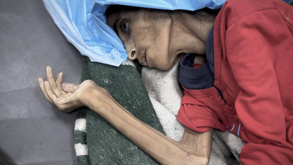 A starving woman in a hospital bed in Gaza.