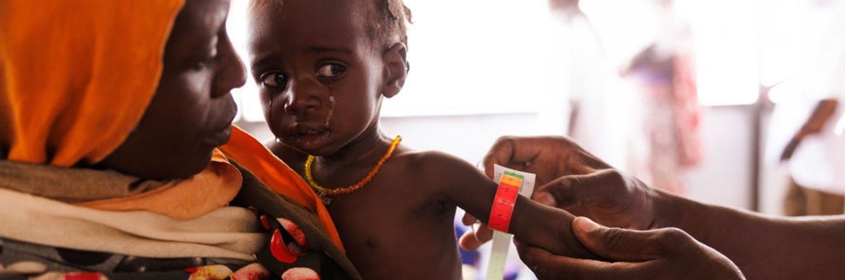 A Sudanese child cries while being checked for malnutrition