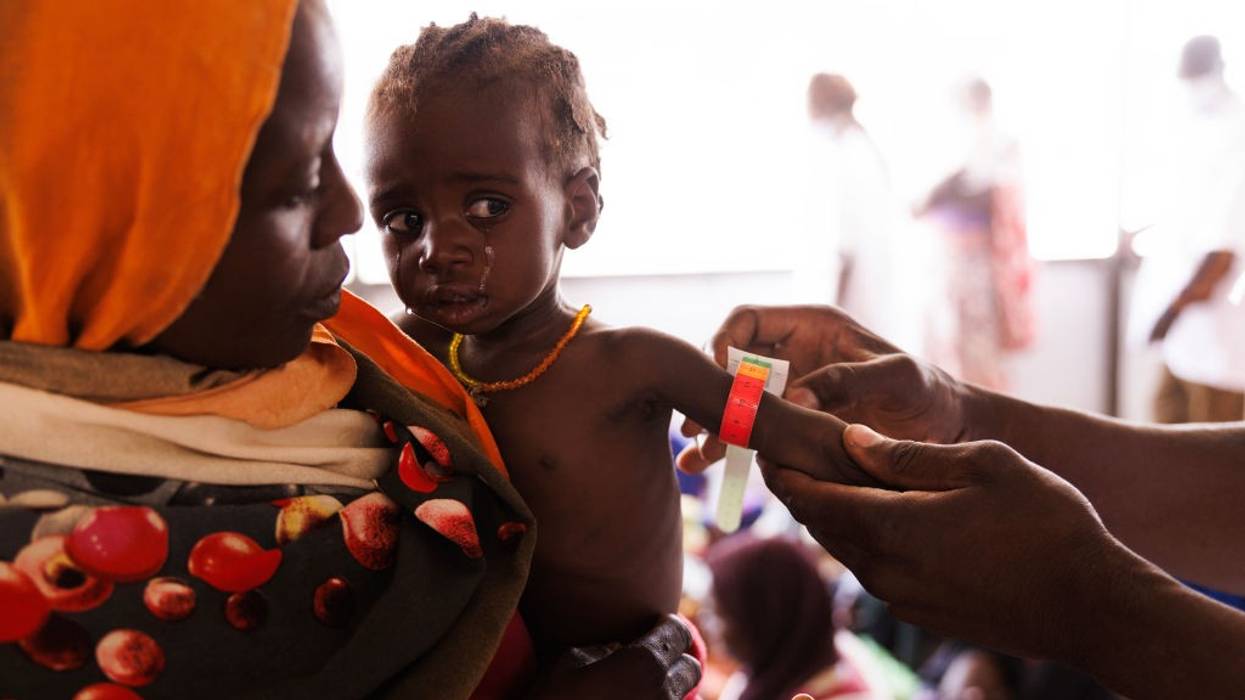 A Sudanese child cries while being checked for malnutrition