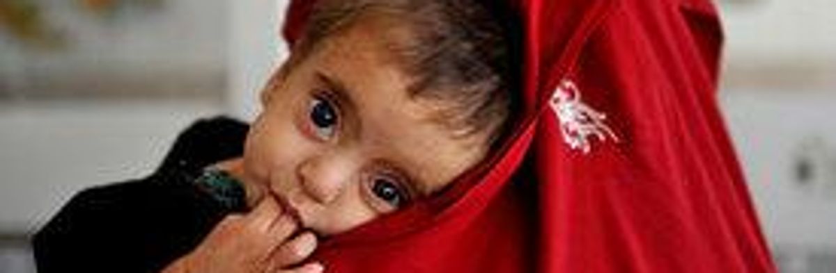 Survey: Level of Child Malnutrition "Shocking" in War-Torn Afghanistan