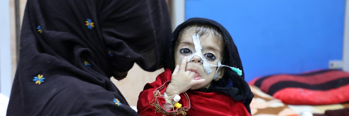 A woman holds an Afghan baby suffering from hunger