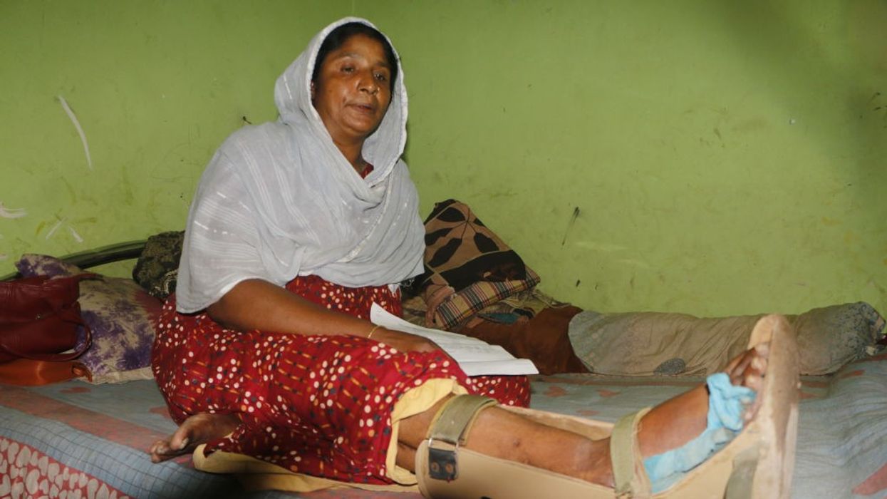 A woman sits with an injured leg.