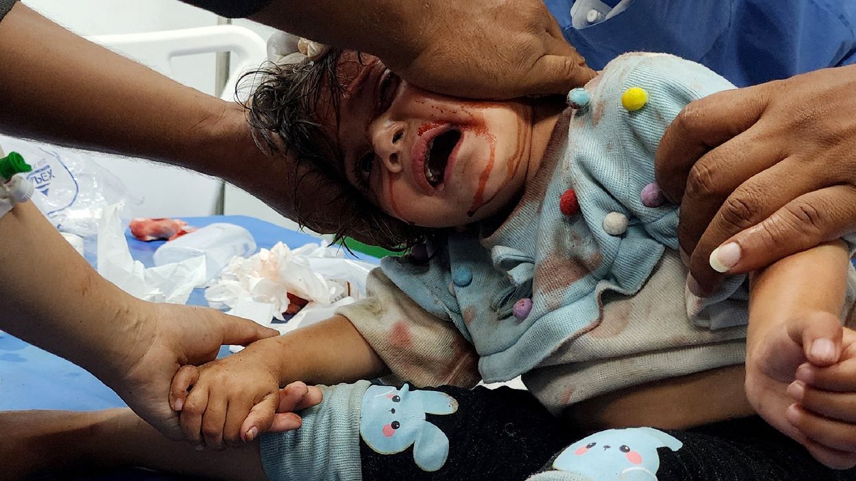 A wounded child is brought to UAE Hospital in Rafah after Israel bombed tents full of displaced Gazans, killing at least 45 and severely wounding hundreds