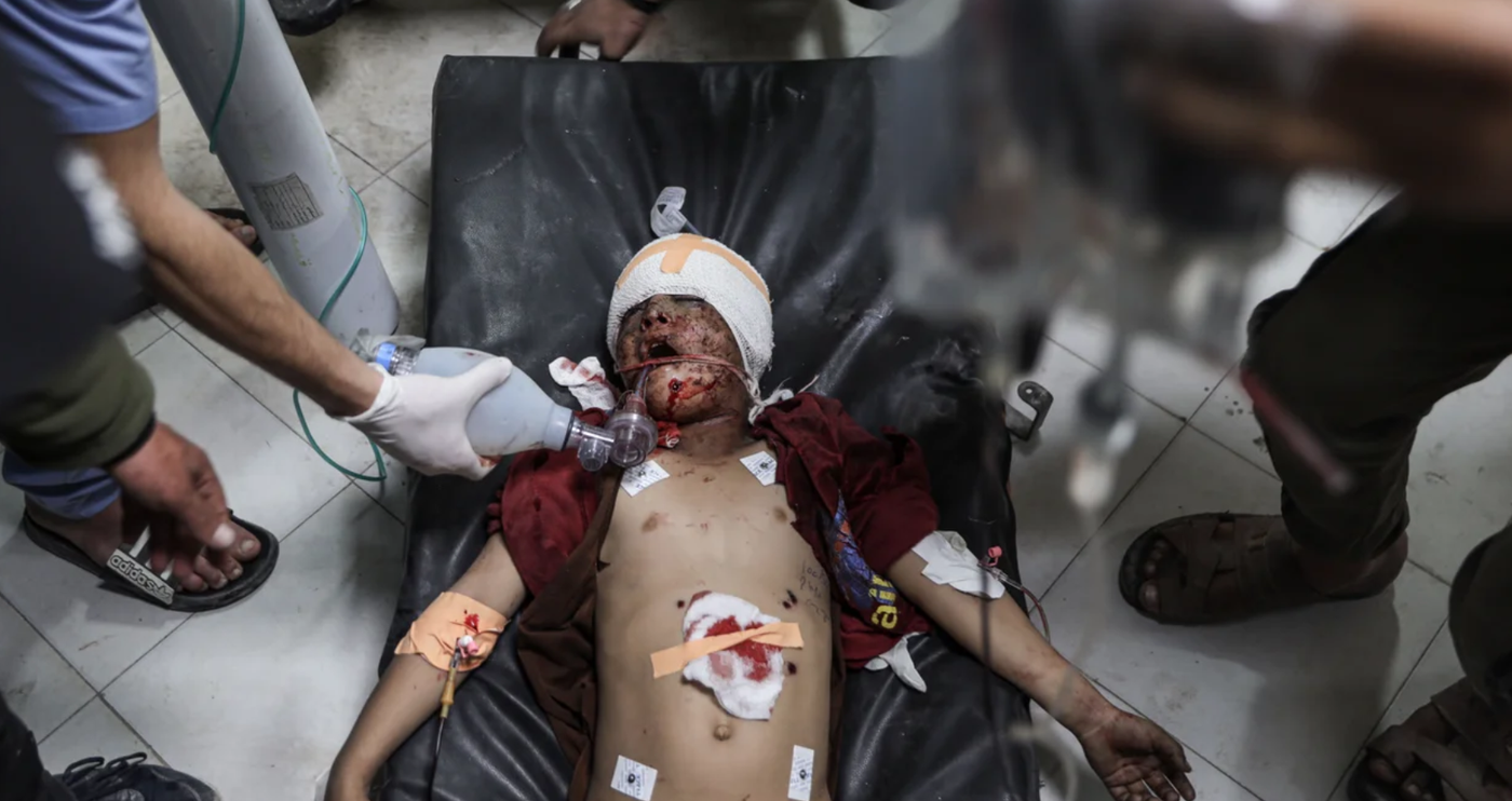 A wounded Palestinan child is treated at Indonesia Hospital