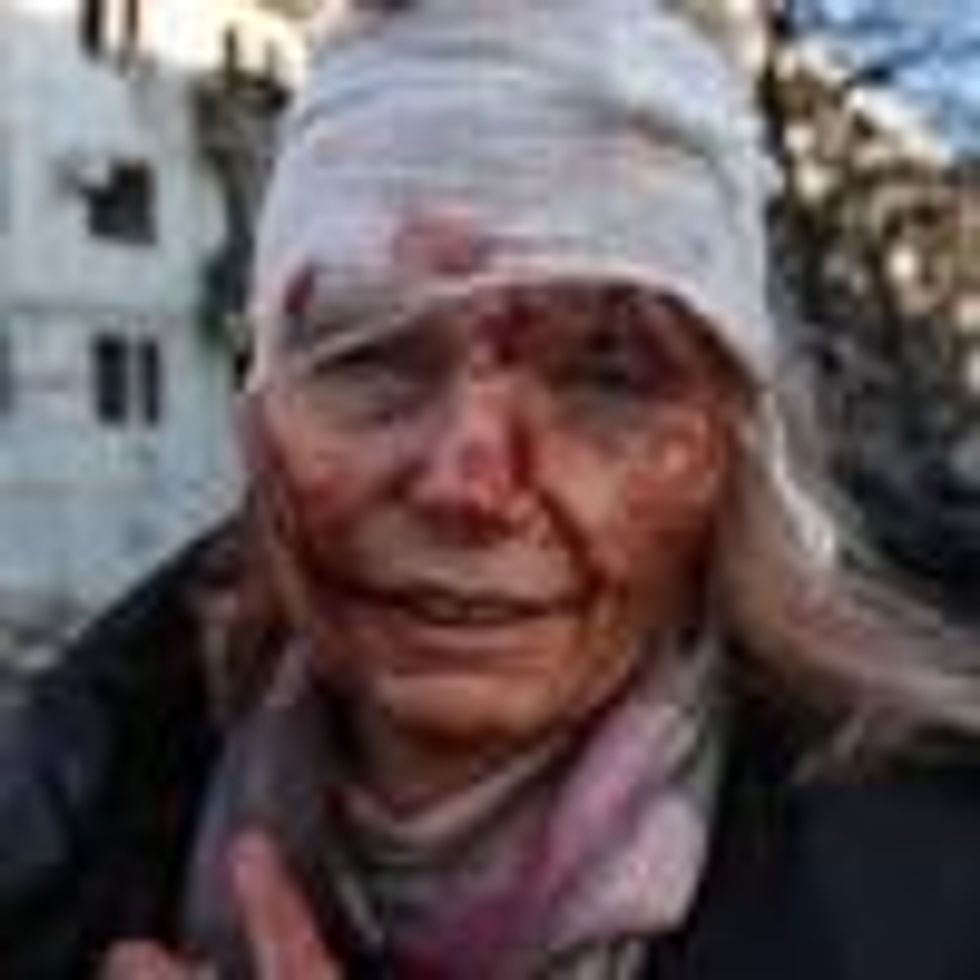 A wounded woman is seen after an apartment complex outside of Kharkiv, Ukraine was hit by Russian bombs on February 24, 2022.