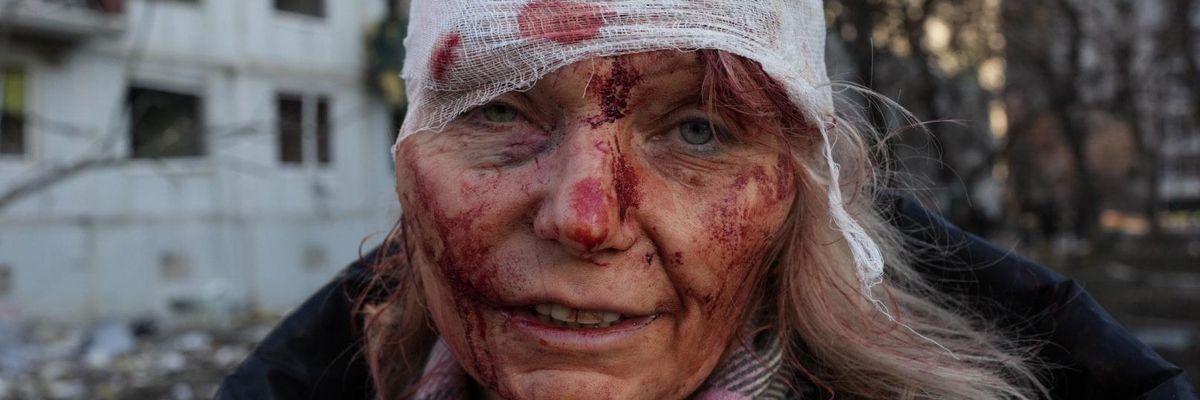 A wounded woman is seen after an apartment complex outside of Kharkiv, Ukraine was hit by Russian bombs on February 24, 2022.