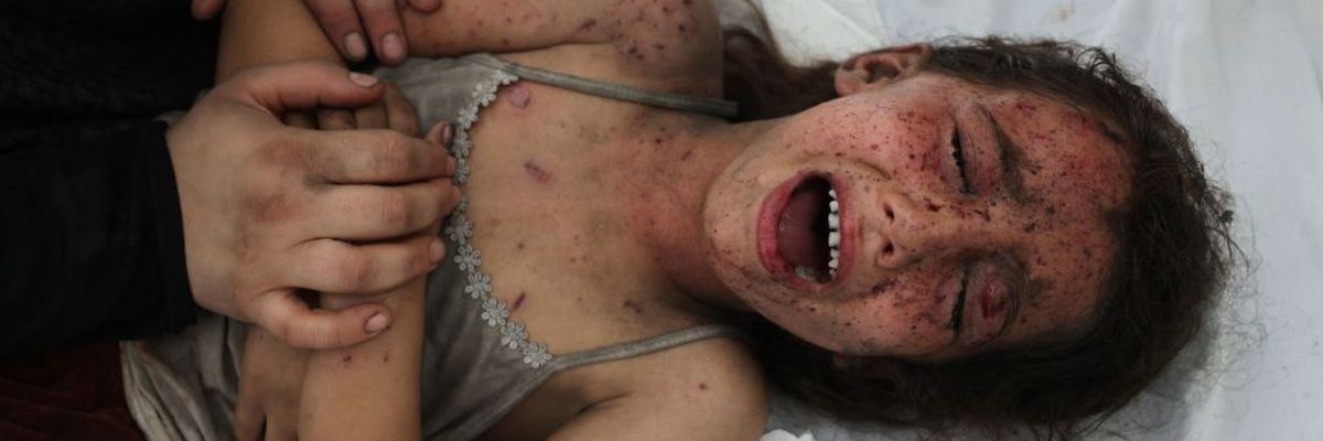 A young Palestinian girl is treated after she was wounded by an Israeli air strike in Rafah