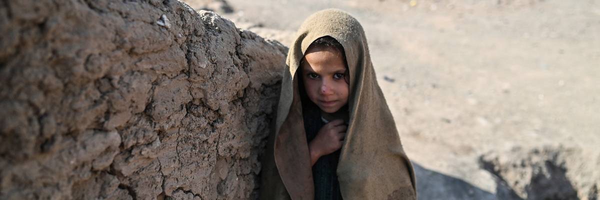 AFGHANISTAN-CHILDREN-HUNGER