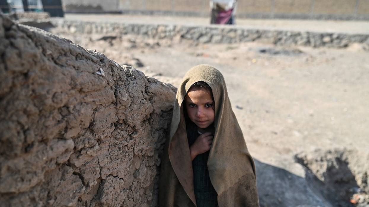 AFGHANISTAN-CHILDREN-HUNGER