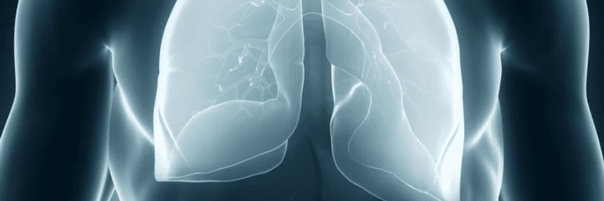 ALEC's Deadly Asbestos Agenda Benefits Koch Industries, Nationwide