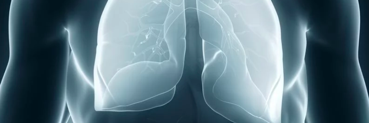 ALEC's Deadly Asbestos Agenda Benefits Koch Industries, Nationwide