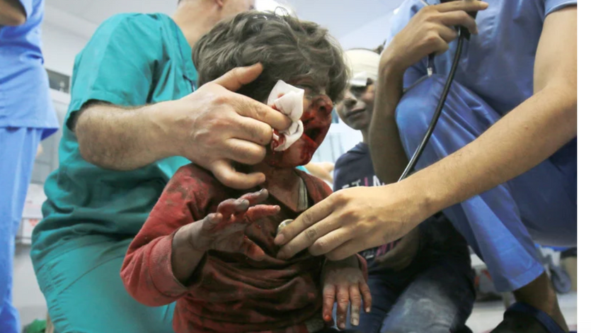 An injured child is treated at Gaza City's al-Shifa hospital after Israeli airstrikes.