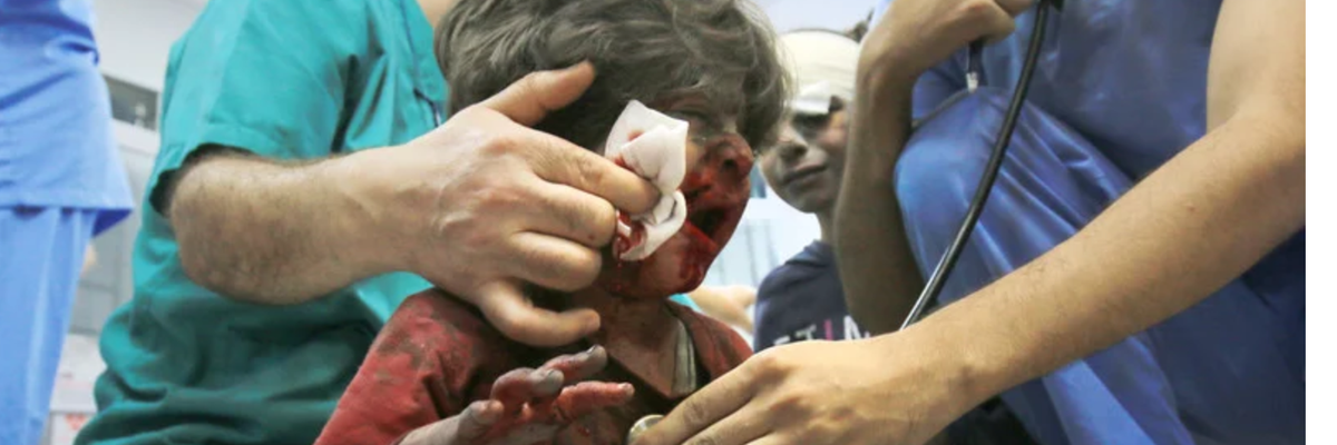 An injured child is treated at Gaza City's al-Shifa hospital after Israeli airstrikes.