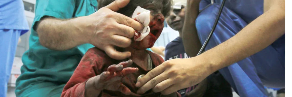 An injured child is treated at Gaza City's al-Shifa hospital after Israeli airstrikes.