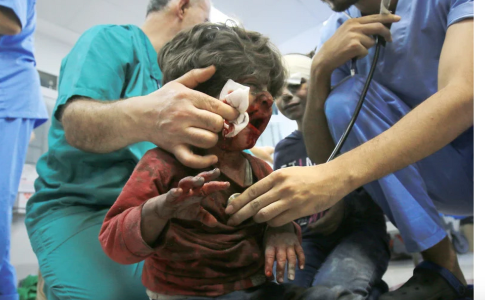 An injured child is treated at Gaza City's al-Shifa hospital after Israeli airstrikes.