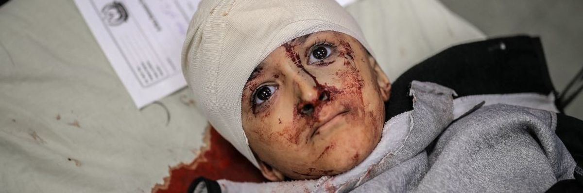 An injured Palestinian child 