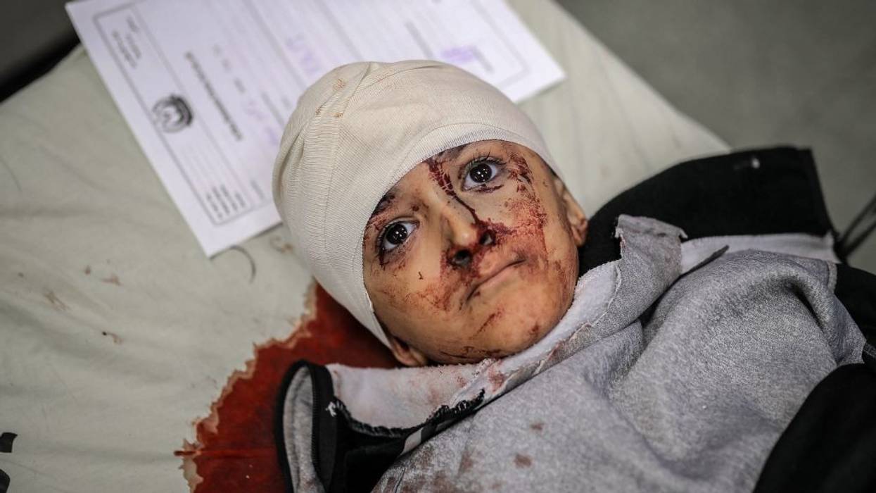 An injured Palestinian child