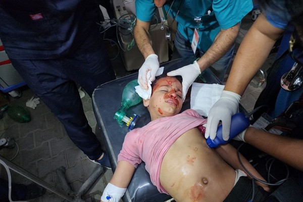an injured Palestinian girl receives treatement in Rafah