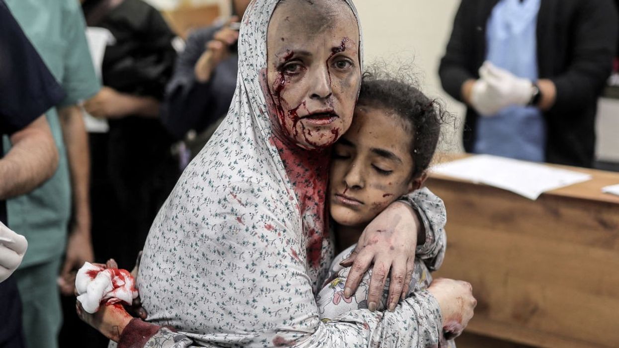 An injured Palestinian woman covered in blood hugs an injured girl after an Israeli bombing