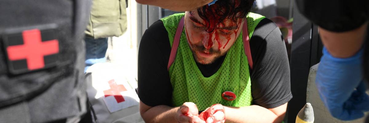 An injured protester with a bloody face receives medical care