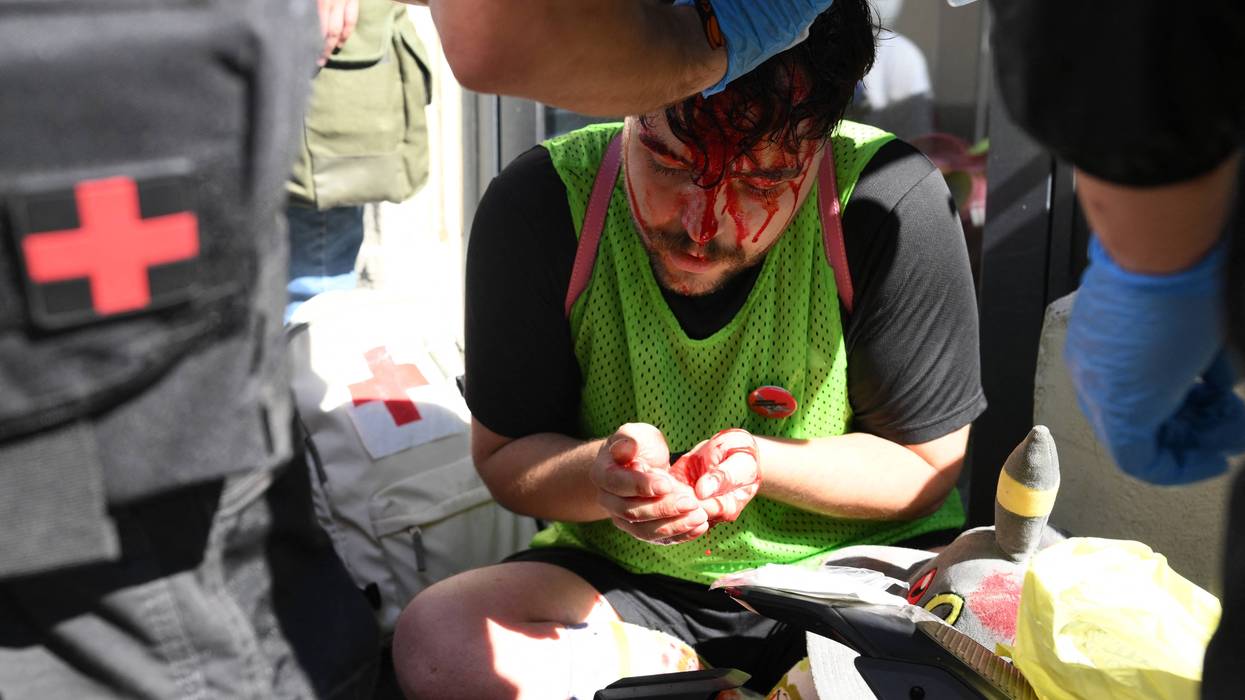 An injured protester with a bloody face receives medical care